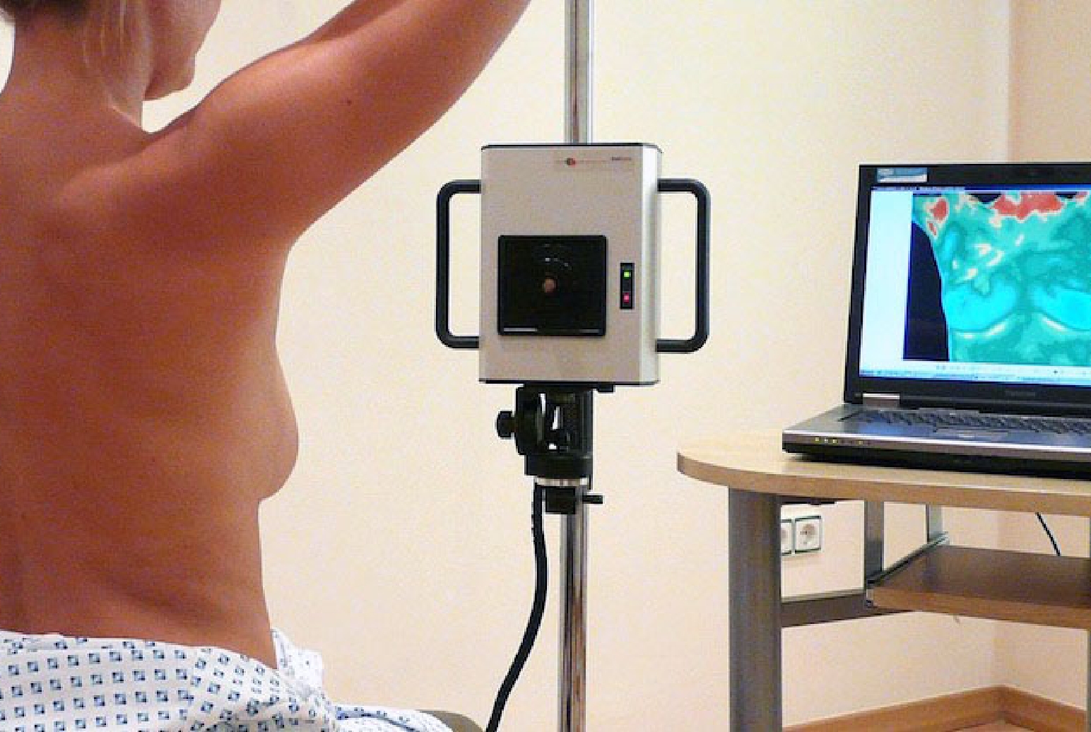 Breast Thermography