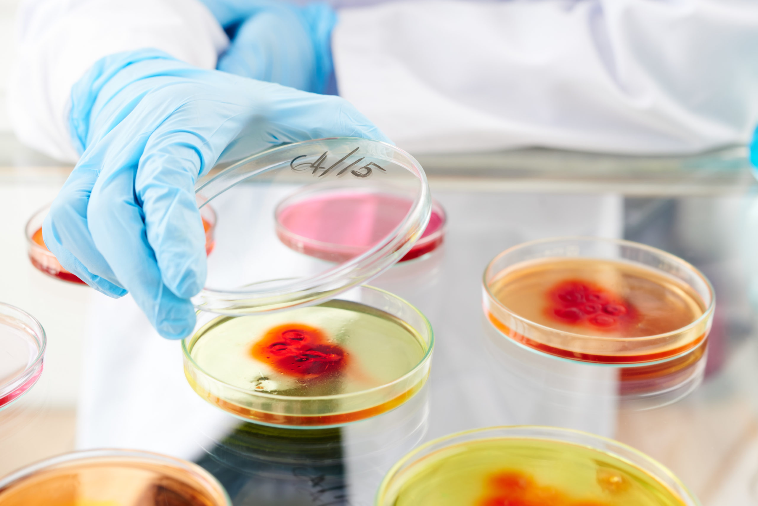 Do You Have Healthy Bacteria in YOUR Breasts?