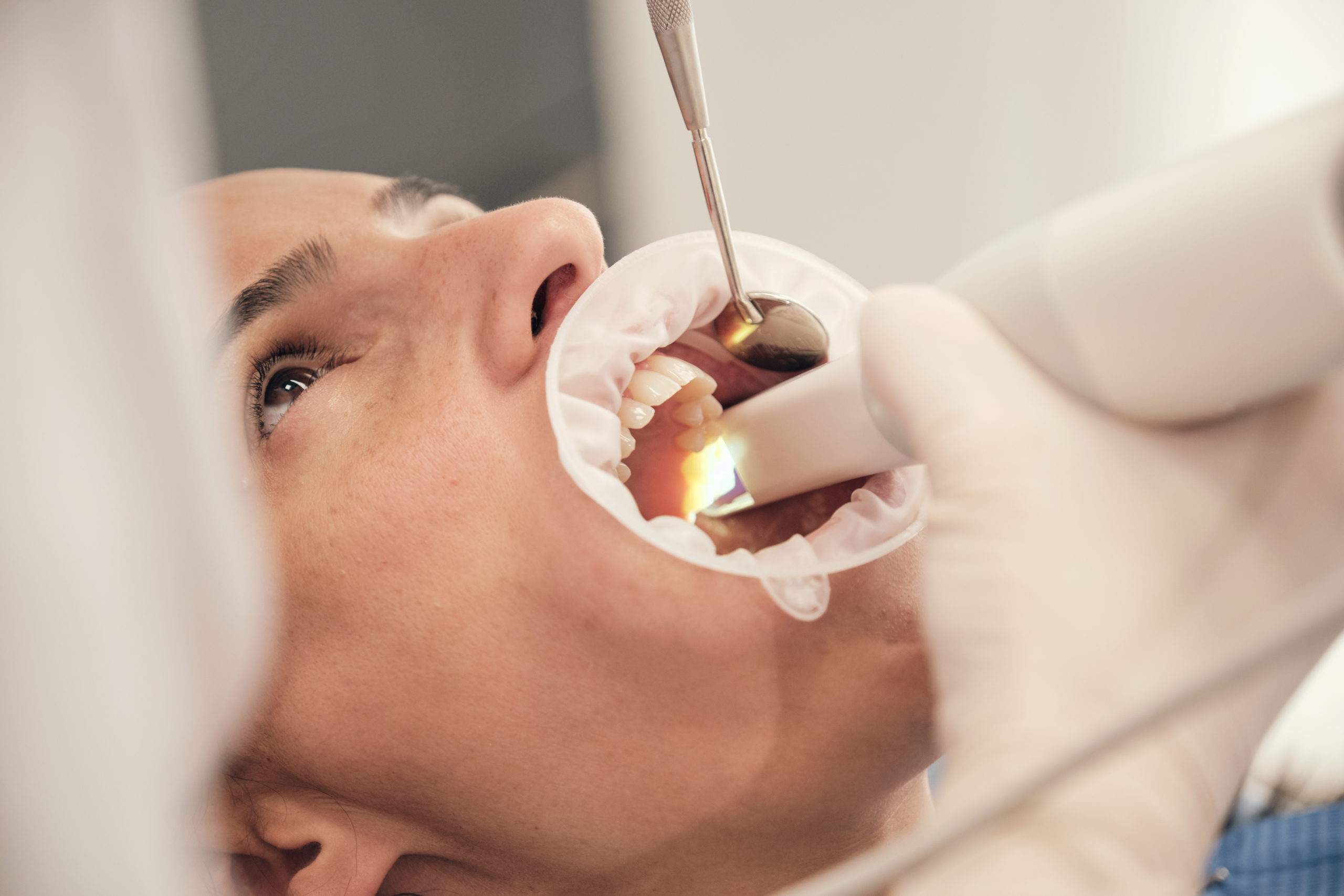 The Link Between Gum Disease and Breast Cancer